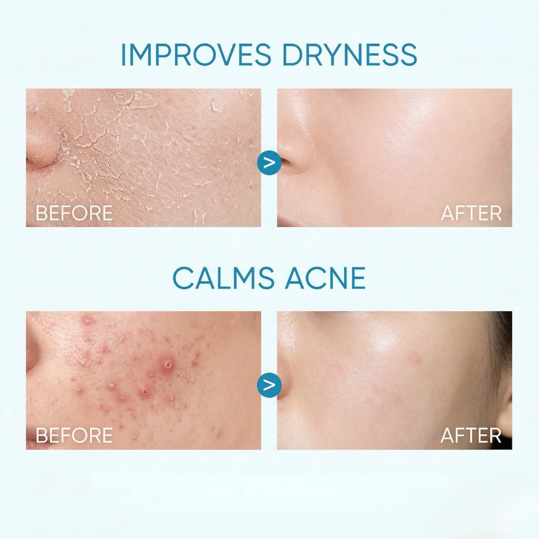 SKINTIFIC 5X Ceramide Barrier Moisture Gel | Lightweight Repairing Moisturizer with Hyaluronic Acid, Centella & Marine Collagen | Soothes Redness, Oil Control & 24H Hydration