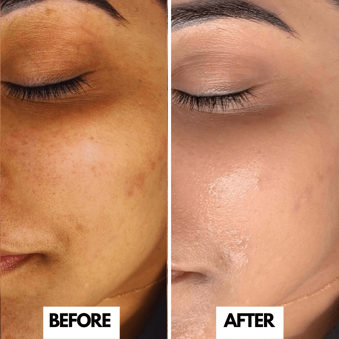 O3+ Bridal Facial Kit | 10-Step Vitamin C Glowing Skin Treatment with D-Tan Pack, Whitening Serum & Arbutin | Salon-Like Bridal Radiance at Home