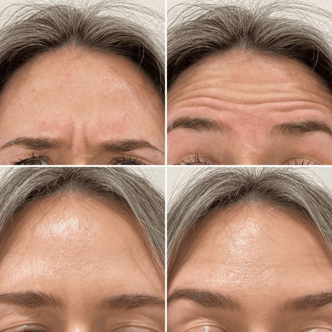 Lift, Tighten & Brighter - Celimax Retinal Glow boosting Cream