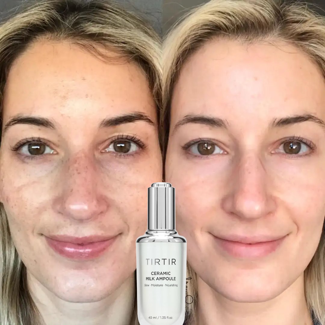 TIRTIR Ceramic Milk Ampoule | 6 Ceramides + Plant-Based Milk for Instant Glass Skin Glow | 50-Hour Deep Hydration & Barrier Strengthening
