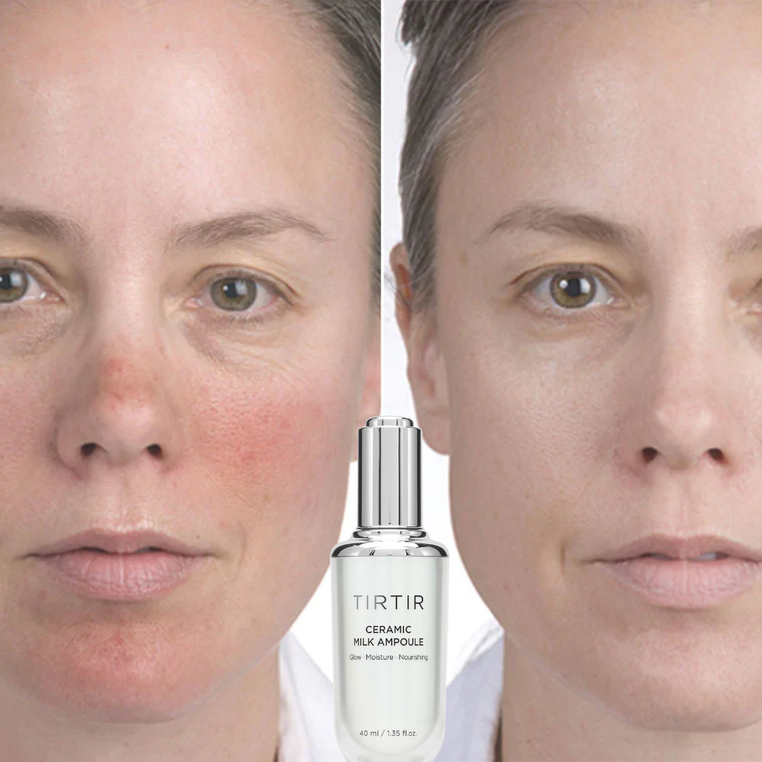 TIRTIR Ceramic Milk Ampoule | 6 Ceramides + Plant-Based Milk for Instant Glass Skin Glow | 50-Hour Deep Hydration & Barrier Strengthening