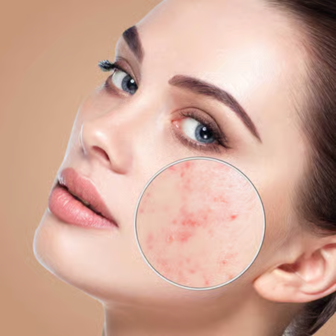 Foxtale Super Glow moisturizer + Primer (glowy & hydrated for smooth base and blur pores)