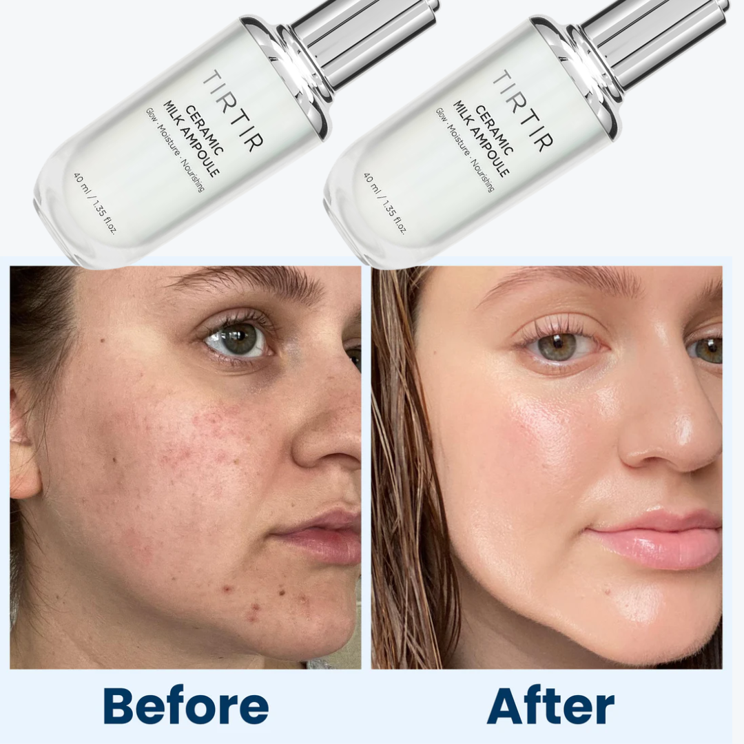 TIRTIR Ceramic Milk Ampoule | 6 Ceramides + Plant-Based Milk for Instant Glass Skin Glow | 50-Hour Deep Hydration & Barrier Strengthening