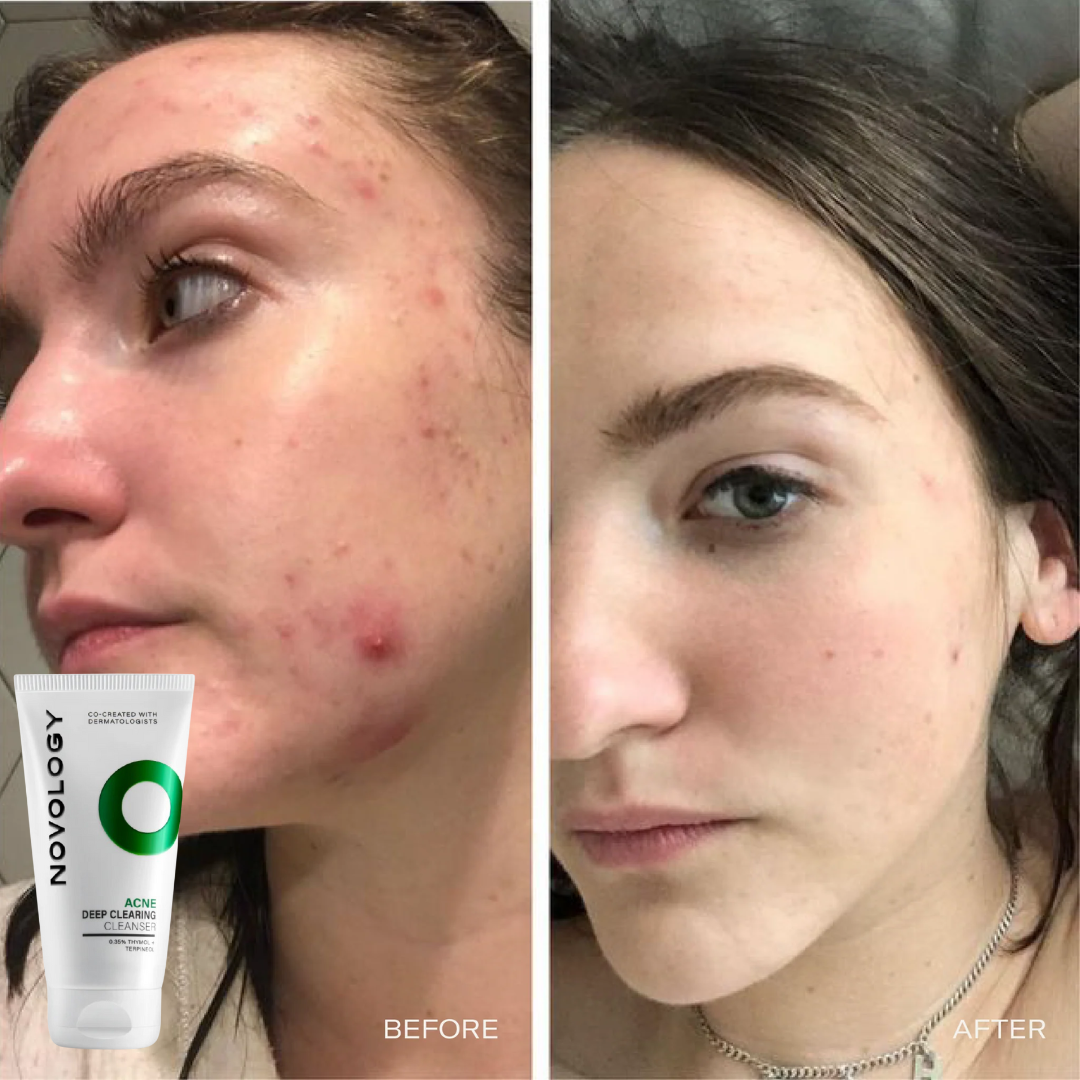 Novology clearing cleanser