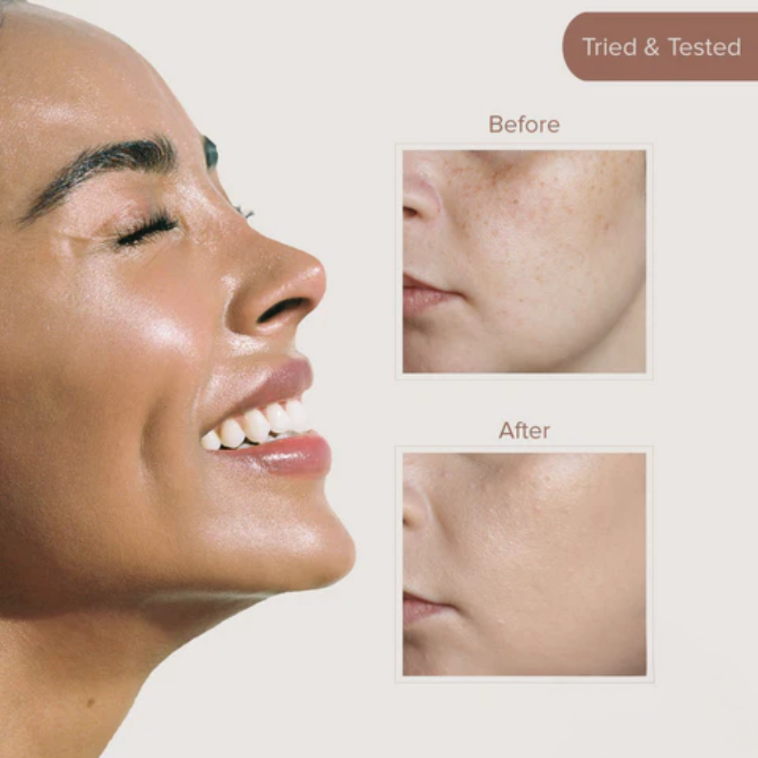 TIRTIR Ceramic Milk Ampoule | 6 Ceramides + Plant-Based Milk for Instant Glass Skin Glow | 50-Hour Deep Hydration & Barrier Strengthening