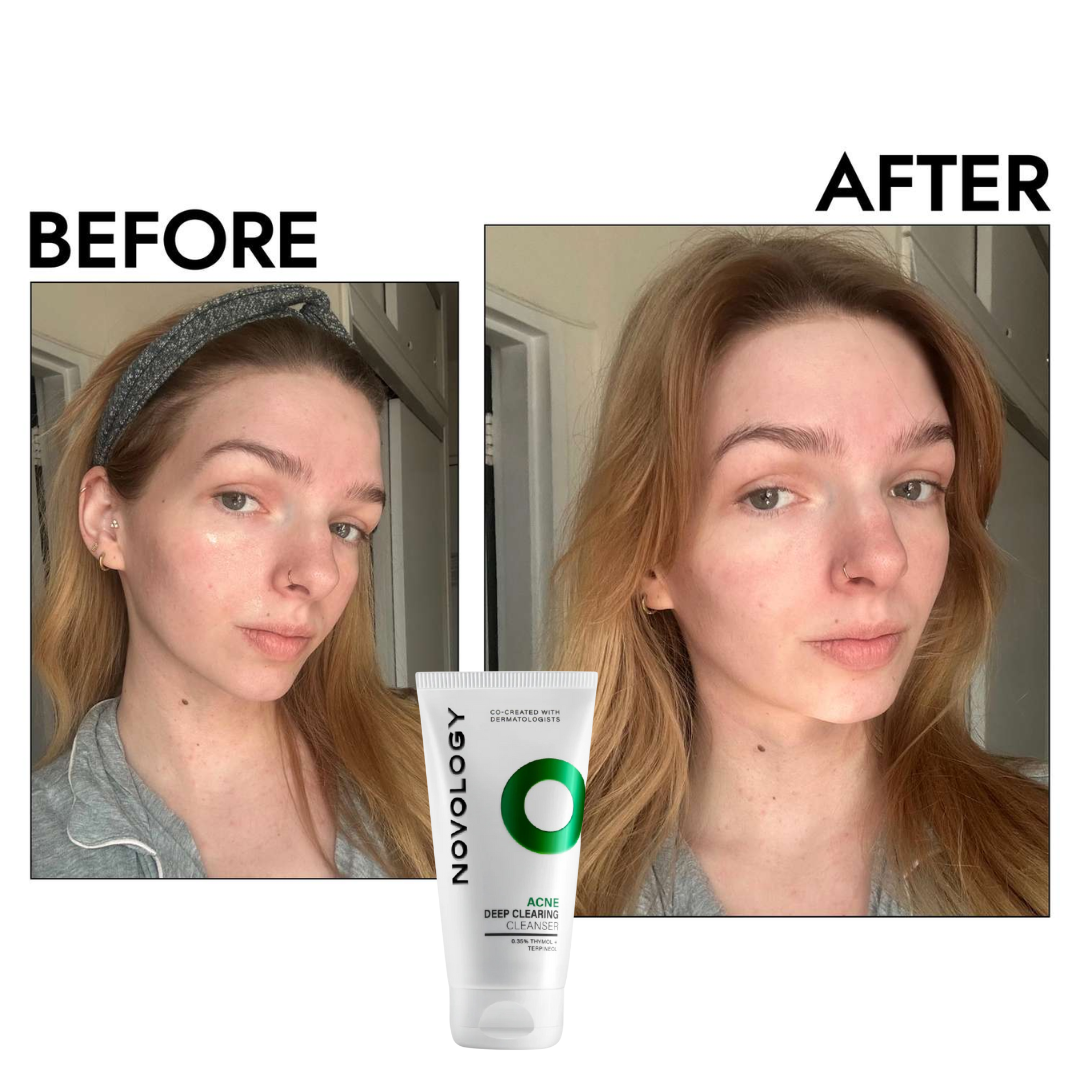 Novology clearing cleanser