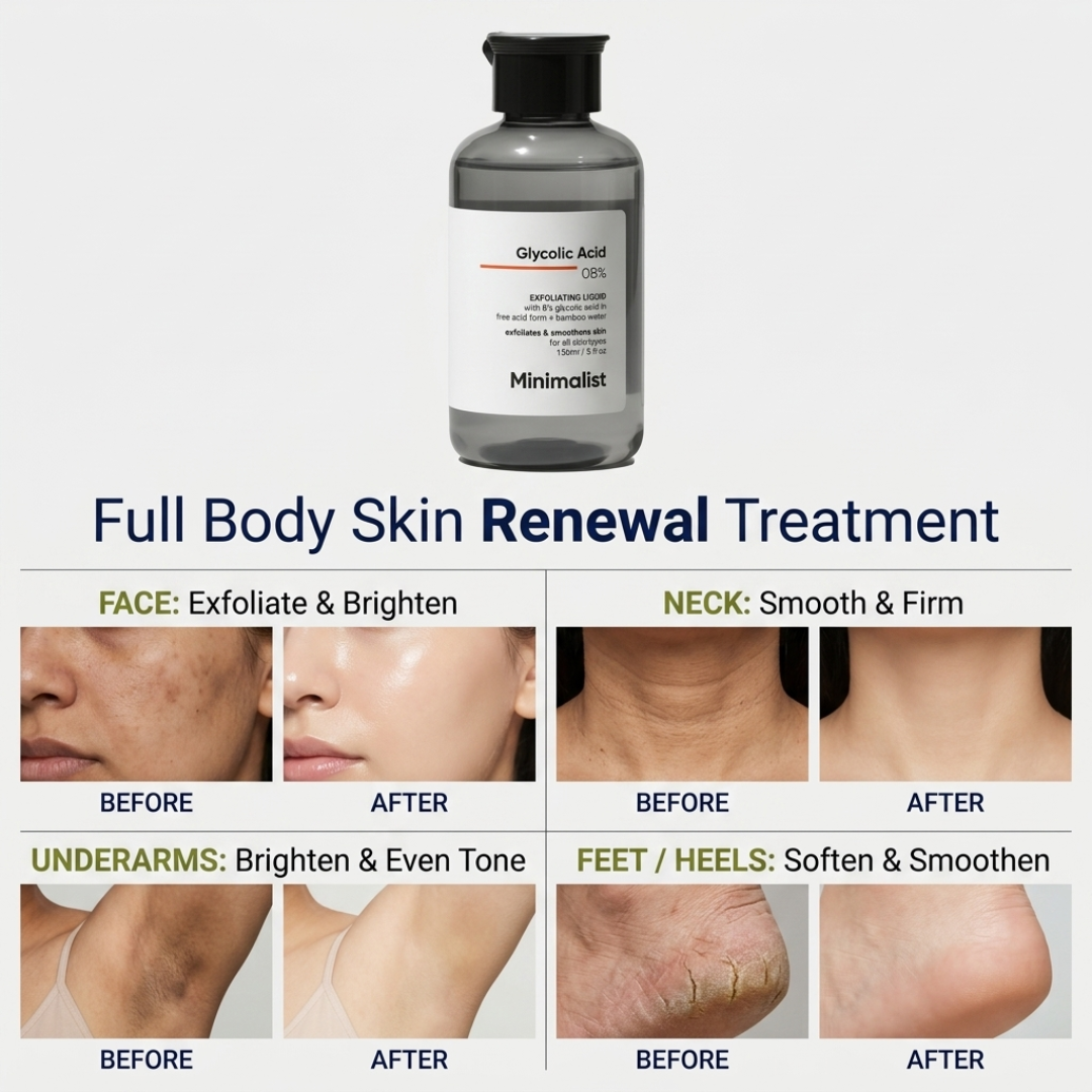 Minimalist 8% Glycolic Acid Exfoliating Toner – Exfoliate, Brighten & Smooth Skin Texture – For Face, Neck, Underarms & Feet – With Bamboo Water & Aloe Extract – Fades Pigmentation, Dark Patches, Dryness & Cracked Heels