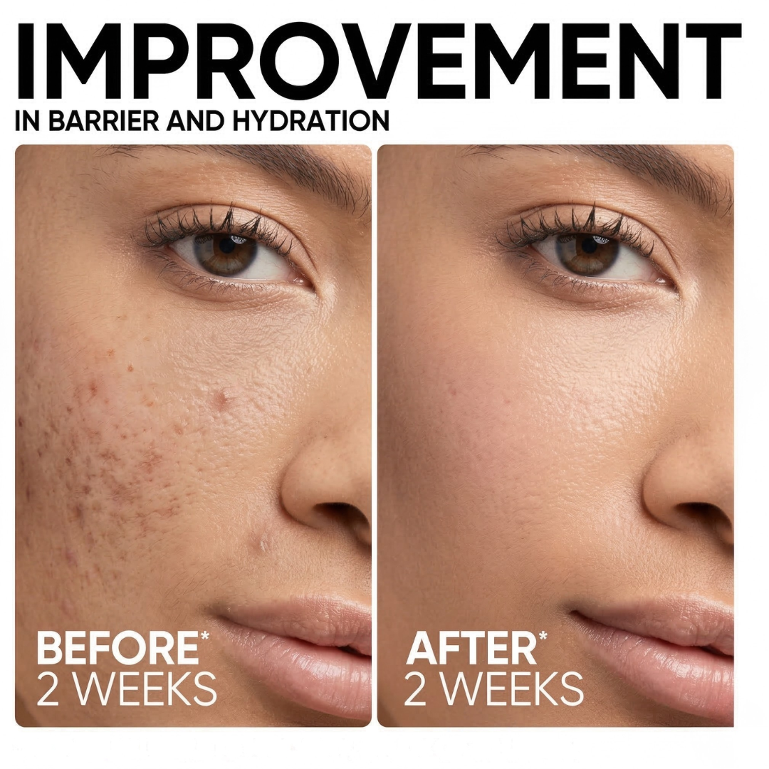 SKINTIFIC 5X Ceramide Barrier Moisture Gel | Lightweight Repairing Moisturizer with Hyaluronic Acid, Centella & Marine Collagen | Soothes Redness, Oil Control & 24H Hydration