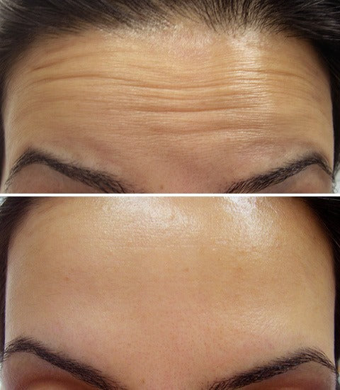 Lift, Tighten & Brighter - Celimax Retinal Glow boosting Cream